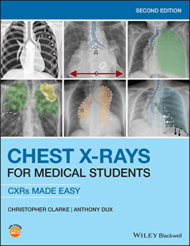 Chest X-Rays for Medical Students: CXRs Made Easy von Wiley-Blackwell