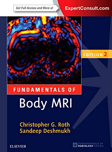 Fundamentals of Body MRI (Fundamentals of Radiology) von Elsevier