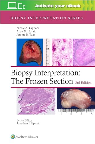 Biopsy Interpretation: The Frozen Section von Lippincott Williams&Wilki