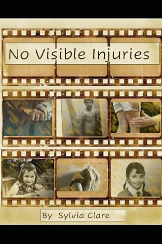 No Visible Injuries