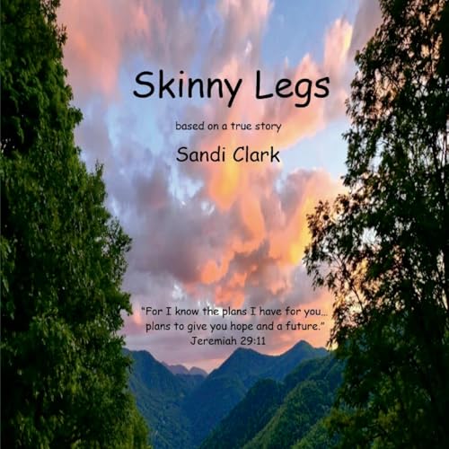Skinny Legs: based on a true story von Lulu.com
