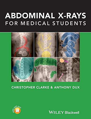 Abdominal X-rays for Medical Students von Wiley