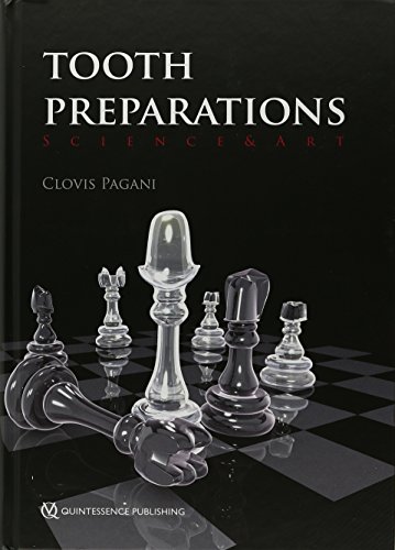 Tooth Preparations: Science & Art Tooth Preparations: Science & Art von Quintessence Publishing