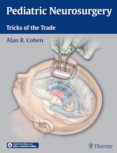Pediatric Neurosurgery: Tricks of the Trade: Plus e-content online