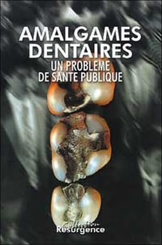 Amalgames dentaires Amalgames dentaires