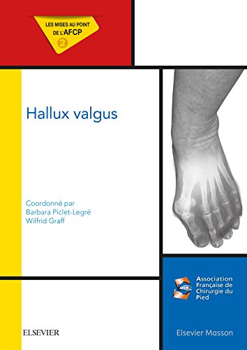 Hallux valgus: Mises au point de l'AFCP Hallux valgus: Mises au point de l'AFCP