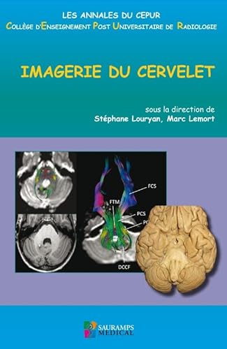 IMAGERIE DU CERVELET
