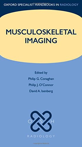 Musculoskeletal Imaging (Oxford Specialist Handbooks in Radiology) von Oxford University Press