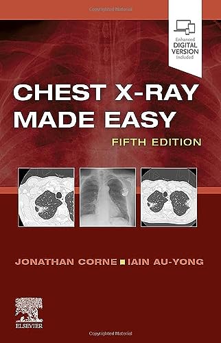 Chest X-Ray Made Easy von Elsevier