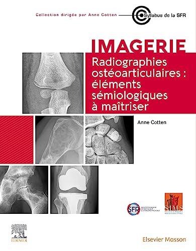 Radiographies ostéoarticulaires : éléments sémiologiques à maitriser: Éléments Sémiologiques À Maitriser