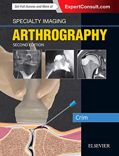 Specialty Imaging: Arthrography: ExpertConsult.com von Elsevier