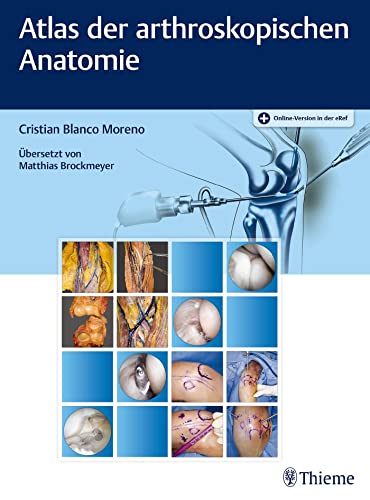 Atlas der arthroskopischen Anatomie von Thieme