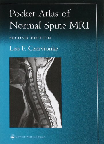 Pocket Atlas of Spinal MRI (Radiology Pocket Atlas)