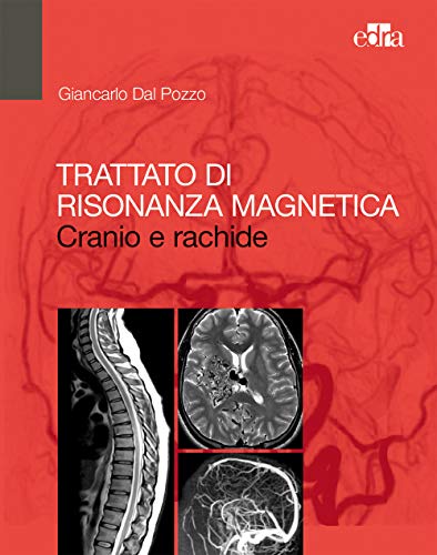 Trattato di risonanza magnetica. Cranio e rachide Trattato di risonanza magnetica. Cranio e rachide