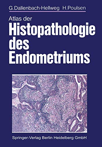 Atlas der Histopathologie des Endometriums von Springer