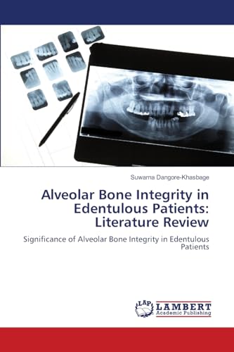 Alveolar Bone Integrity in Edentulous Patients: Literature Review: Significance of Alveolar Bone Integrity in Edentulous Patients von LAP LAMBERT Academic Publishing