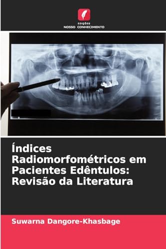 Índices Radiomorfométricos em Pacientes Edêntulos: Revisão da Literatura von Edições Nosso Conhecimento