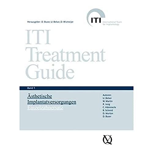 ITI Treatment Guide Band 1: Ästhetische Implantattherapie: Einzelzahnersatz (ITI Treatment Guide: Deutsche Ausgabe) von Quintessenz Verlag