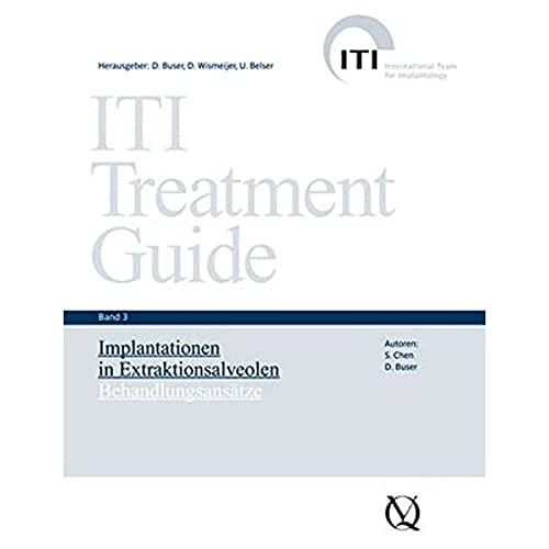 ITI Treatment Guide Band 3: Implantationen in Extraktionsalveolen: Behandlungsmöglichkeiten (ITI Treatment Guide: Deutsche Ausgabe) von Quintessenz Verlag