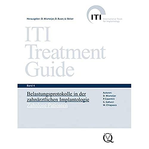 ITI Treatment Guide Band 4: Belastungsprotokolle in der zahnärztlichen Implantologie - Zahnlose Patienten (ITI Treatment Guide: Deutsche Ausgabe)
