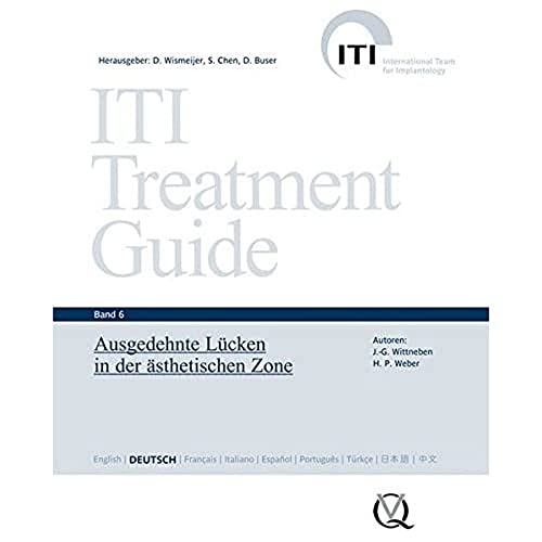 ITI Treatment Guide Band 6: Ausgedehnte Lücken in der ästhetischen Zone (ITI Treatment Guide: Deutsche Ausgabe) von Quintessenz Verlags-GmbH