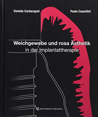 Weichgewebe und rosa Ästhetik in der Implantattherapie von Quintessenz Verlags-GmbH