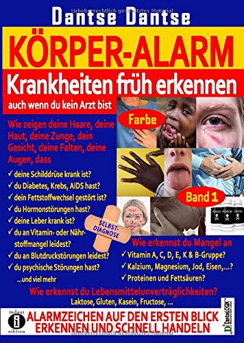 KÖRPER-ALARM - Krankheiten früh erkennen, auch wenn du kein Arzt bist! Bd. 1 (FARBE): Wie zeigen deine Haare, deine Haut, deine Zunge, dein Gesicht, ... woran erkennst du Mangelerscheinungen?