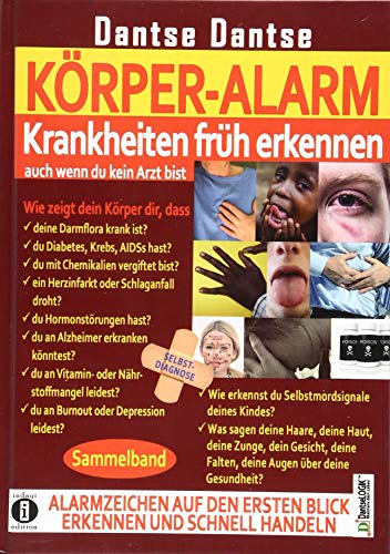 KÖRPER-ALARM - Krankheiten früh erkennen, auch wenn du kein Arzt bist! Sammelband:: Wie zeigen deine Haare, deine Haut, deine Zunge, deine Augen woran ... und häufige psychische Krankheiten erkennen