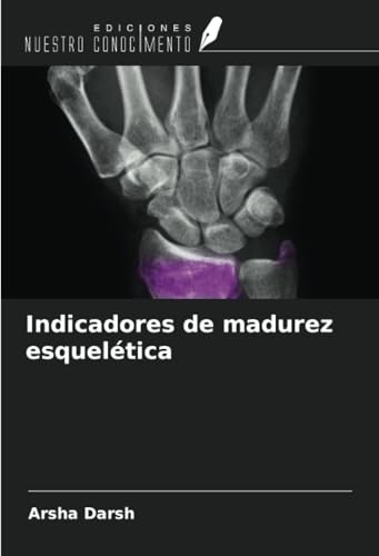 Indicadores de madurez esquelética von Ediciones Nuestro Conocimiento