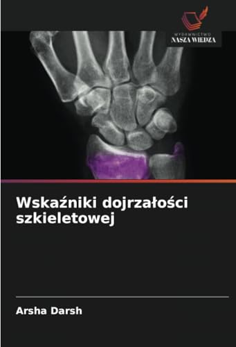 Wskaźniki dojrzałości szkieletowej: DE von Wydawnictwo Nasza Wiedza