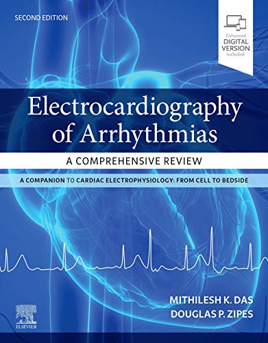 Electrocardiography of Arrhythmias: A Comprehensive Review: A Companion to Cardiac Electrophysiology von Elsevier