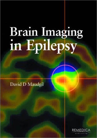 Brain Imaging in Epilepsy: Insights and Applications
