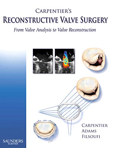 Carpentier's Reconstructive Valve Surgery von Saunders