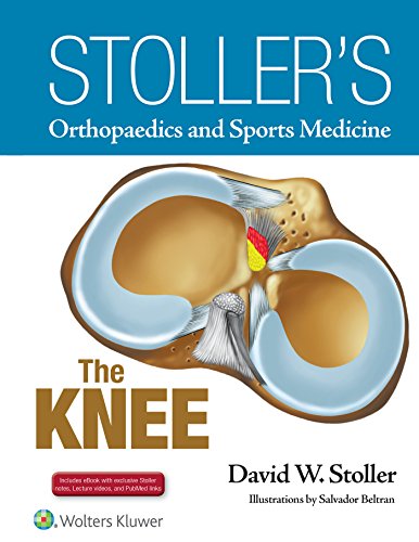 Stoller's Orthopaedics and Sports Medicine: The Knee: Includes Stoller Lecture Videos and Stoller Notes, the full text in ebook format von LWW