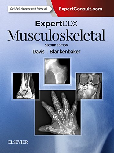 ExpertDDx: Musculoskeletal: Diagnostic Imaging. ExpertConsult.com von Elsevier