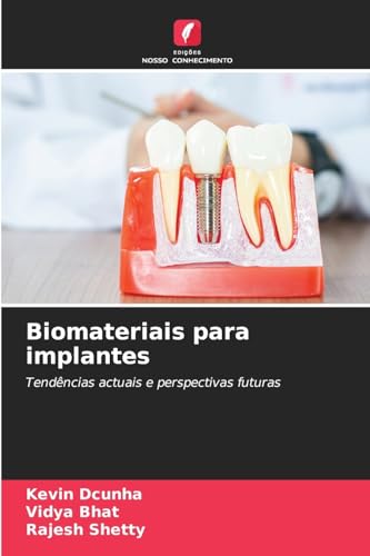 Biomateriais para implantes: Tendências actuais e perspectivas futuras von Edições Nosso Conhecimento