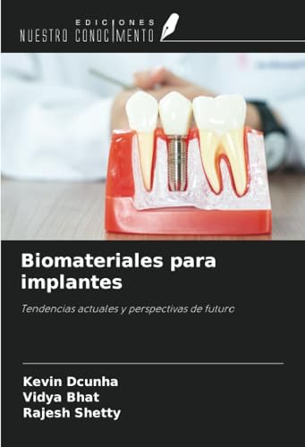 Biomateriales para implantes: Tendencias actuales y perspectivas de futuro von Ediciones Nuestro Conocimiento