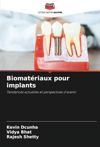 Biomatériaux pour implants: Tendances actuelles et perspectives d'avenir von Editions Notre Savoir