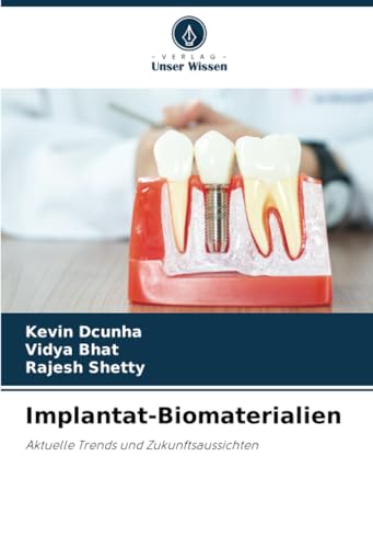 Implantat-Biomaterialien: Aktuelle Trends und Zukunftsaussichten von Verlag Unser Wissen