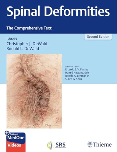 Spinal Deformities: The Comprehensive Text