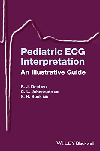 Pediatric ECG Interpretation: An Illustrated Guide