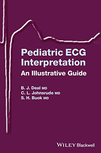 Pediatric ECG Interpretation: An Illustrated Guide Pediatric ECG Interpretation: An Illustrated Guide