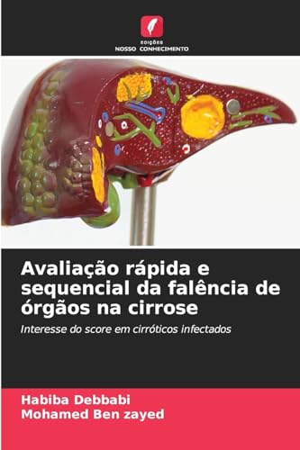Avaliação rápida e sequencial da falência de órgãos na cirrose: Interesse do score em cirróticos infectados von Edições Nosso Conhecimento