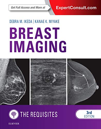 Breast Imaging: The Requisites (The Core Requisites) von Elsevier