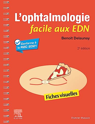 L'ophtalmologie facile aux EDN: Fiches visuelles