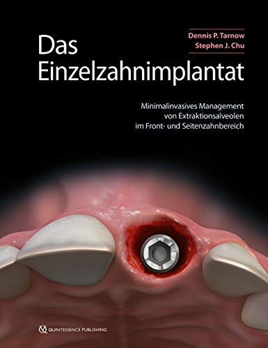 Das Einzelzahnimplantat: Minimalinvasives Management von Extraktionsalveolen im Front- und Seitenzahnbereich von Quintessenz Verlags-GmbH