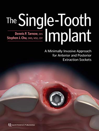 The Single-Tooth Implant: A Minimally Invasive Approach for Anterior and Posterior Extraction Sockets von Quintessence Publishing (IL)