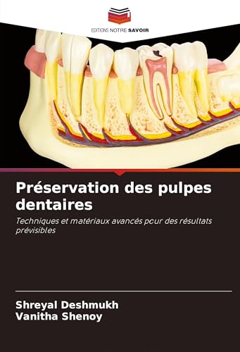 Préservation des pulpes dentaires: Techniques et matériaux avancés pour des résultats prévisibles von Editions Notre Savoir
