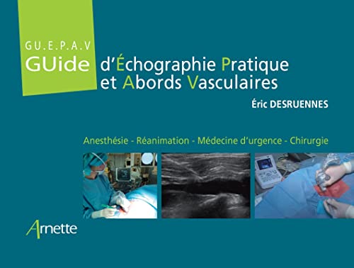 Guide d'Échographie Pratique et Abords Vasculaires (GU.E.P.A.V): Anesthésie - Réanimation - Médecine d'urgence - Chirurgie von ARNETTE EDITION