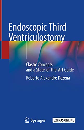 Endoscopic Third Ventriculostomy: Classic Concepts and a State-of-the-Art Guide von Springer